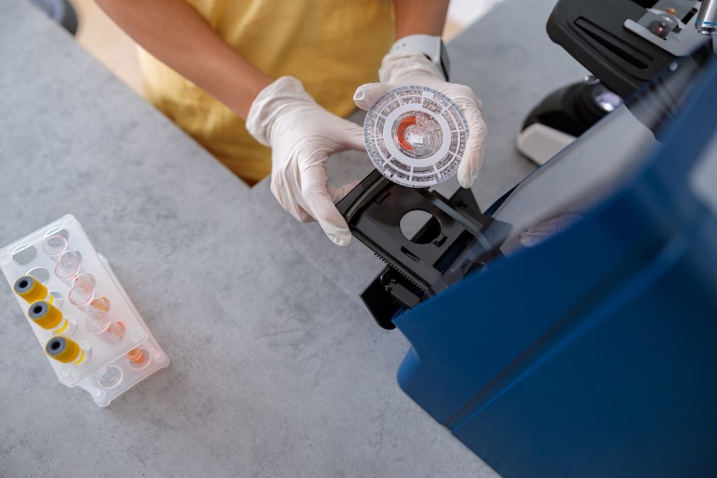High angle view of laboratory assistant examining blood sample in microscope at clinical vet laboratory